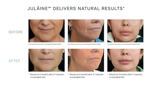 julaine-treatments (1)
